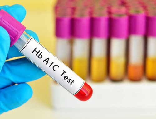 How to Check My A1C at Home