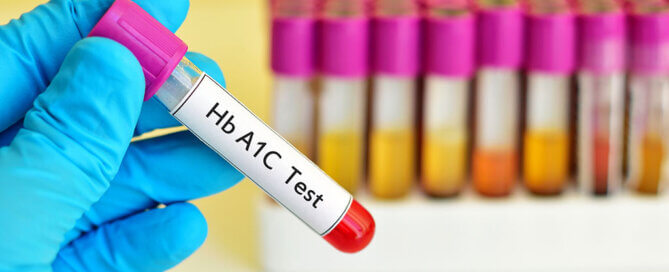 Hand holding results for A1C test