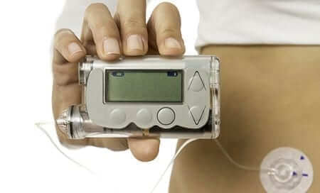 Insulin pump