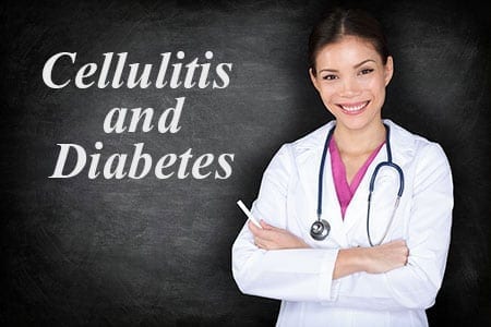 Cellulitis and Diabetes
