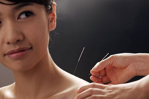 Acupuncture and Diabetes