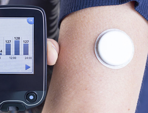 Continuous Glucose Monitoring for Diabetes