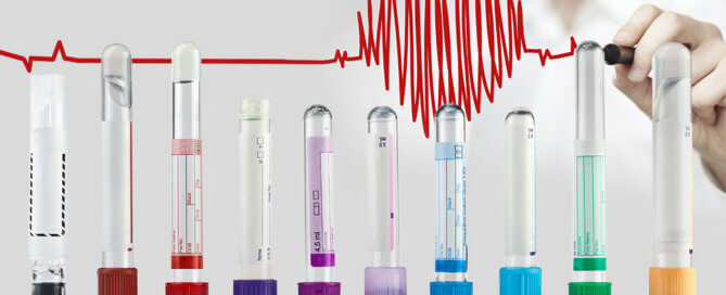 Lab Report Test Vials