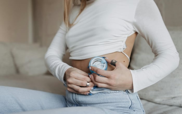 Woman applying an insulin pump to her abdomen