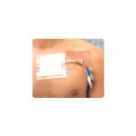 Gentell Cath-Strip Reclosable Catheter Fastener Box of 50 thumbnail