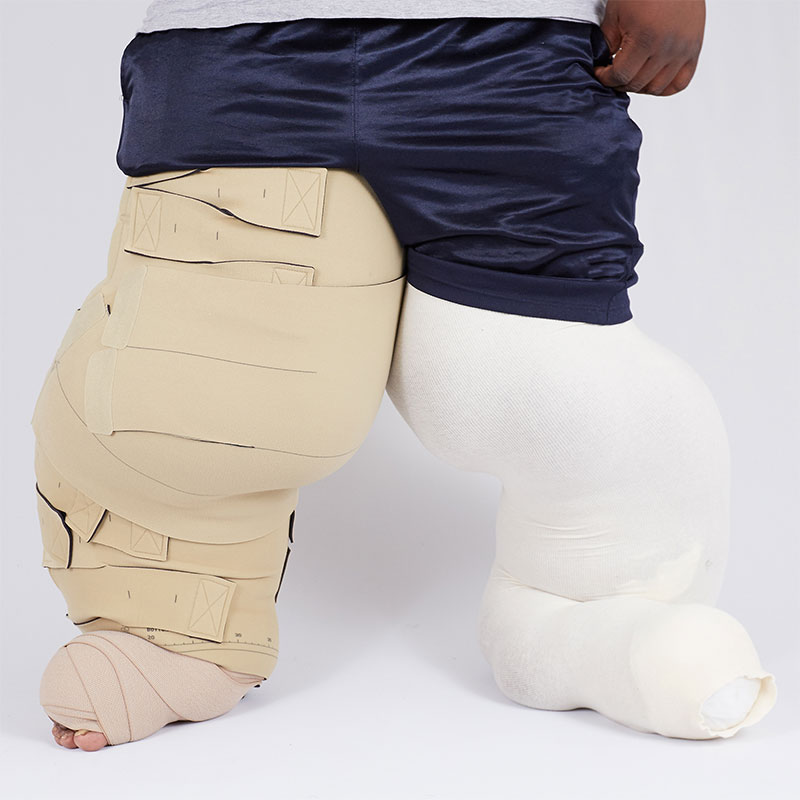 Medi USA Circaid Reduction Kit Lobe