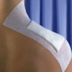 Smith and Nephew Hypafix Tape 2in x 2yd 4215 thumbnail